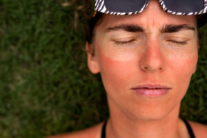 Coup de soleil au visage : causes, prévention et remèdes express pour apaiser rapidement la peau et éviter les brûlures estivales.
