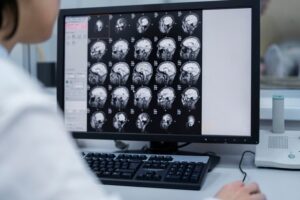 Découvrez comment l’IRM et le scanner permettent de diagnostiquer efficacement l’hypertension intracrânienne grâce à une imagerie médicale précise et adaptée.